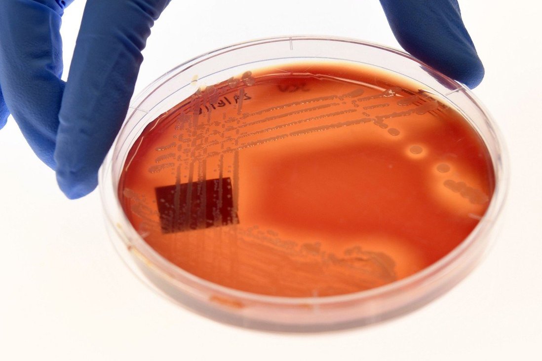   Staphylococcus epidermidis, một loại vi khuẩn được tìm thấy trên da người và là một trong phổ ...