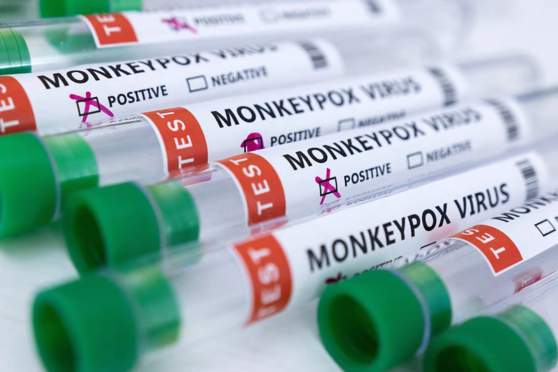 Với sự lây lan của bệnh đậu mùa khỉ sau Covid-19, có nhiều lo ngại sẽ xảy ra các đại dịch lây ...