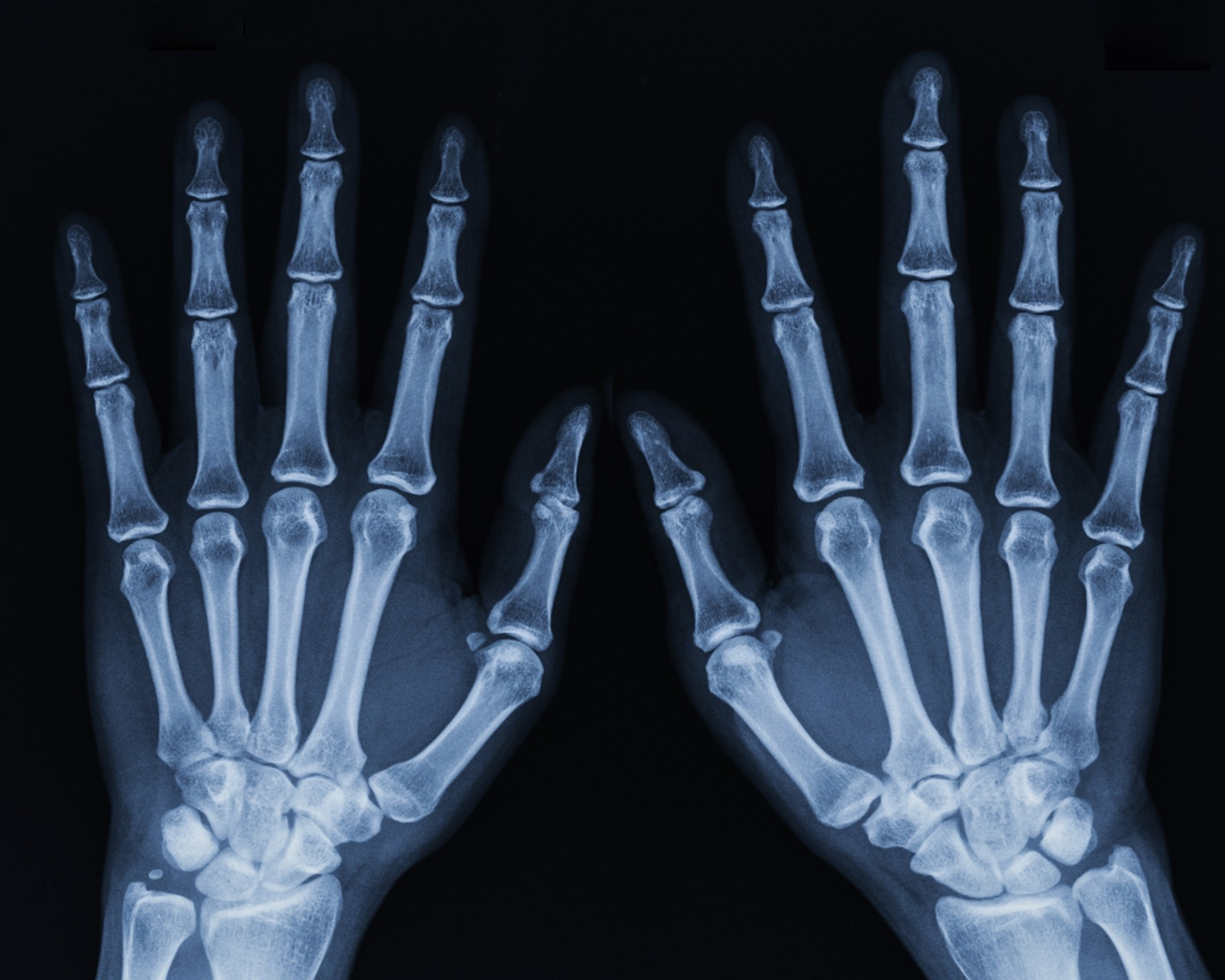 Ảnh chụp X-quang bàn tay con người cho thấy phần nào sự phức tạp của chúng.